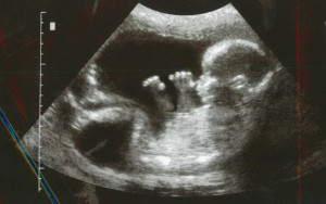 baby-in-womb