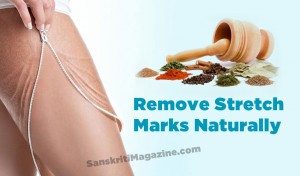 stretch-marks