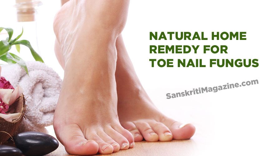 10 Natural Remedies to Get Rid of Nail Fungus - Bellatory