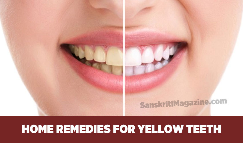 Home remedies for yellow teeth