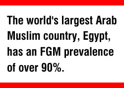 FGM