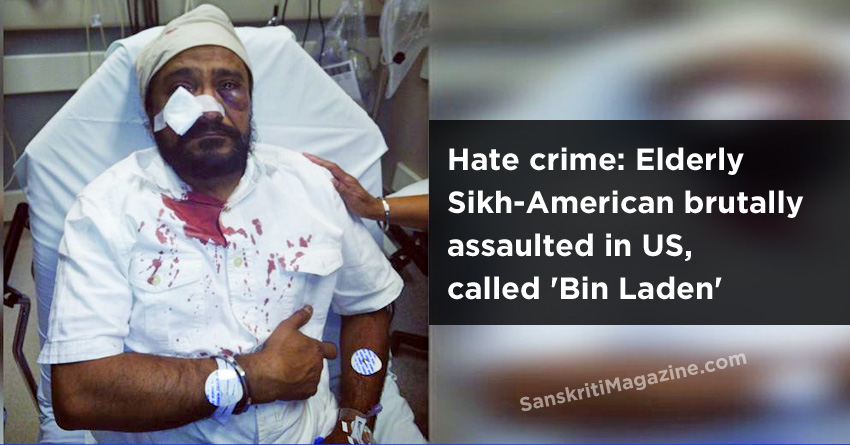 Elderly Sikh-American brutally assaulted in US