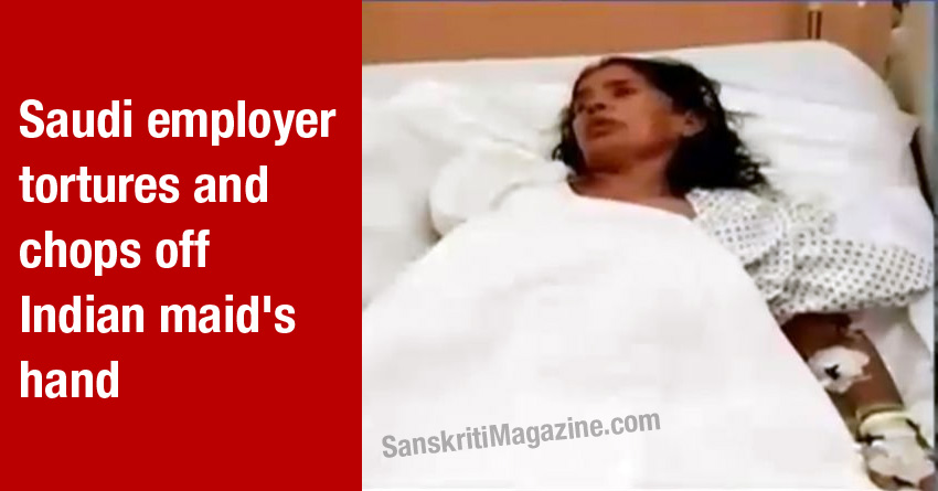 Saudi employer chops off Indian maid's hand